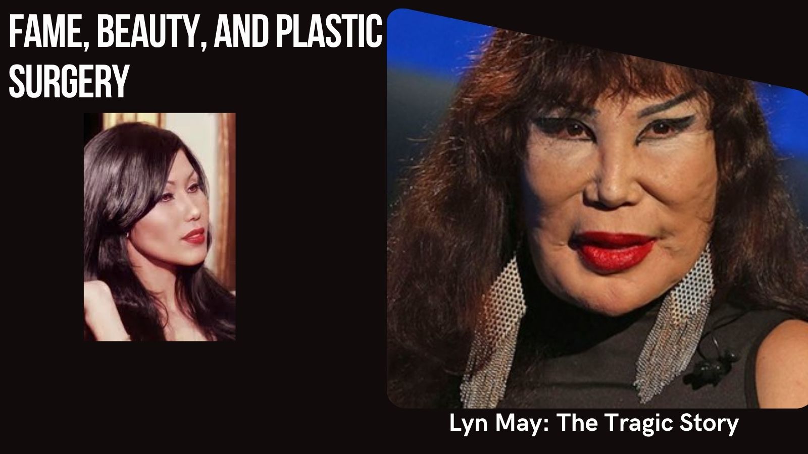 Lyn May: The Tragic Story Behind Fame, Beauty, and Plastic Surgery